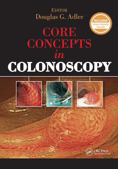 Book cover of Core Concepts in Colonoscopy