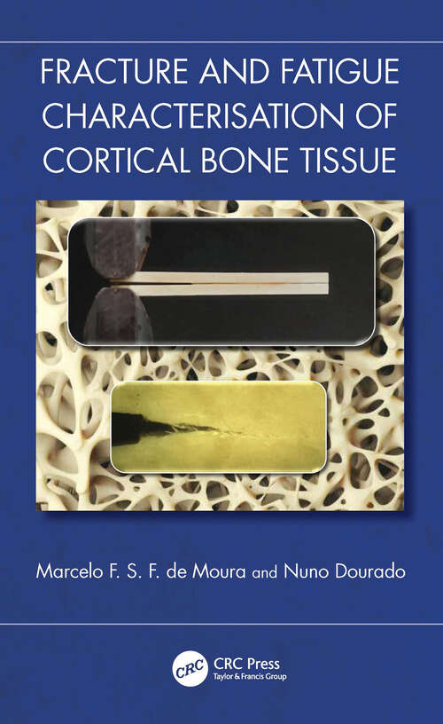 Book cover of Fracture and Fatigue Characterisation of Cortical Bone Tissue