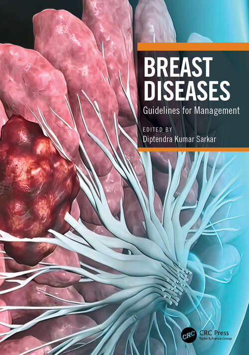 Book cover of Breast Diseases: Guidelines for Management