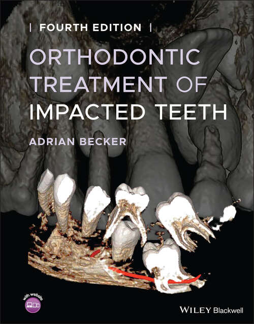 Book cover of Orthodontic Treatment of Impacted Teeth (4)