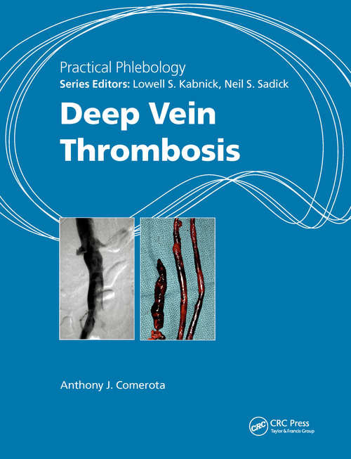 Book cover of Practical Phlebology: Deep Vein Thrombosis (Practical Phlebology)