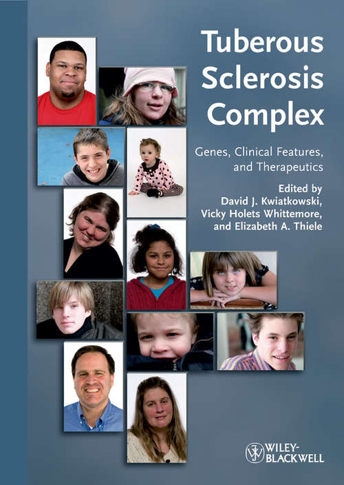 Book cover of Tuberous Sclerosis Complex: Genes, Clinical Features and Therapeutics (3) (Developmental Perspectives In Psychiatry Ser.)