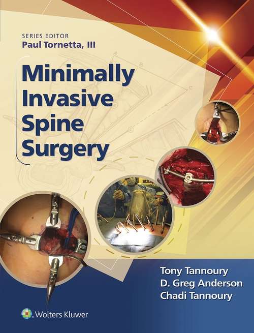 Book cover of Minimally Invasive Spine Surgery