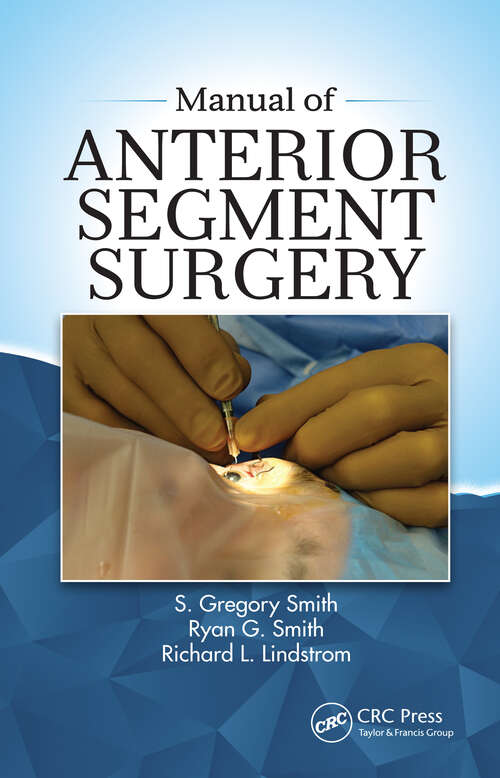 Book cover of Manual of Anterior Segment Surgery