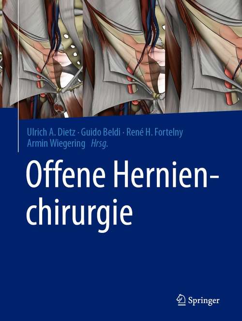 Book cover of Offene Hernienchirurgie (1. Aufl. 2021)