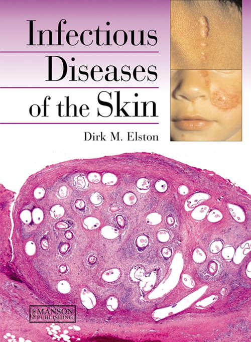 Book cover of Infectious Diseases of the Skin