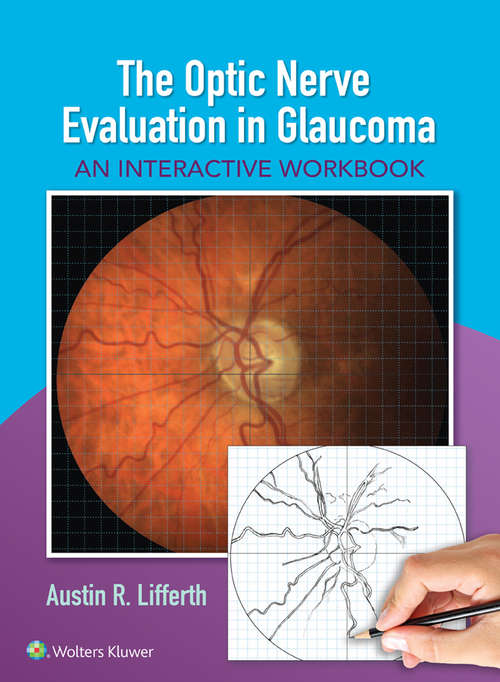 Book cover of The Optic Nerve Evaluation in Glaucoma: An Interactive Workbook