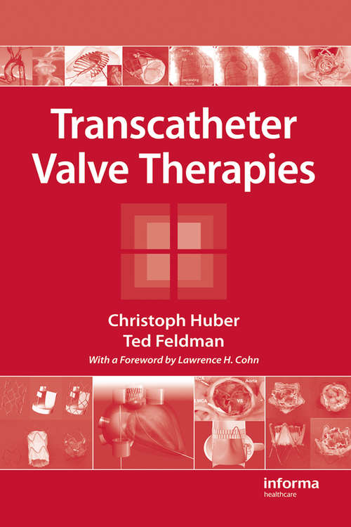 Book cover of Transcatheter Valve Therapies