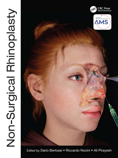 Book cover of Non-Surgical Rhinoplasty (The PRIME Series)