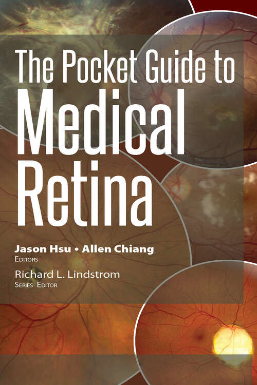 Book cover of The Pocket Guide to Medical Retina (Pocket Guides)