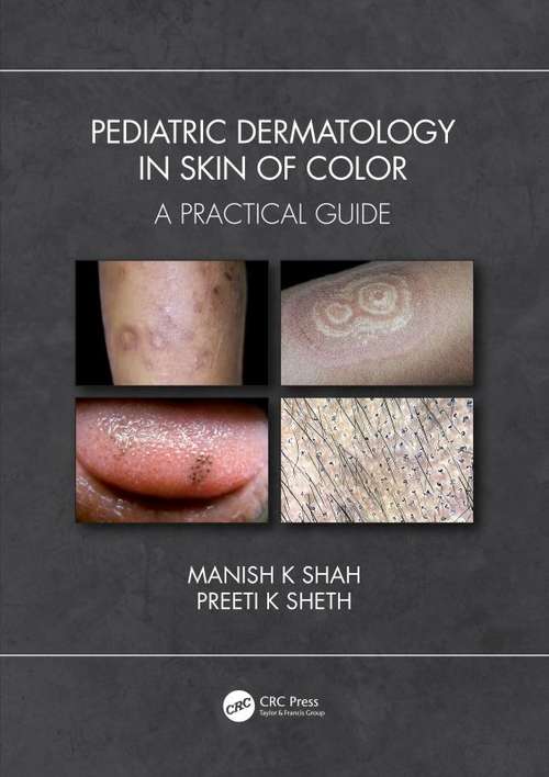 Book cover of Pediatric Dermatology in Skin of Color: A Practical Guide