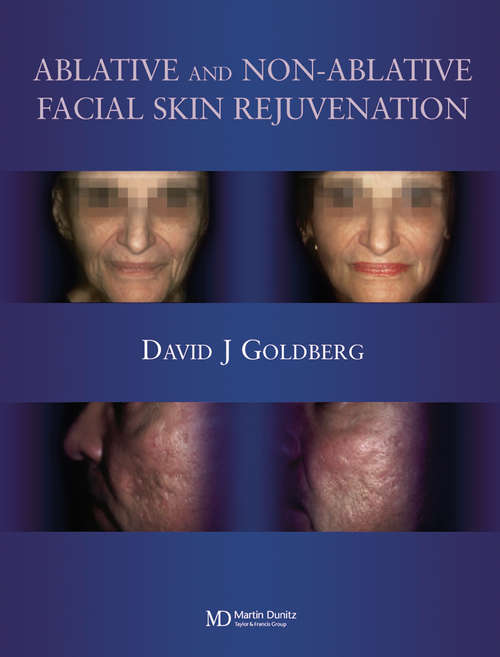 Book cover of Ablative and Non-ablative Facial Skin Rejuvenation