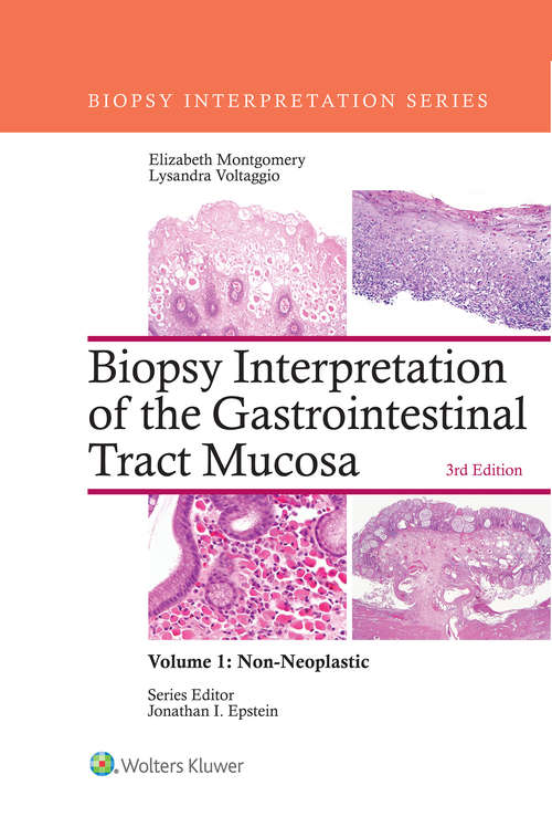 Book cover of Biopsy Interpretation of the Gastrointestinal Tract Mucosa: Volume 1: Non-Neoplastic: Non-neoplastic (3) (Biopsy Interpretation Ser. #1)