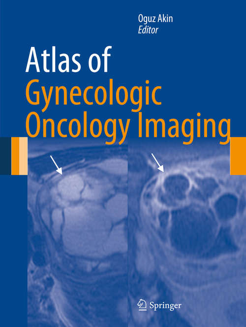 Book cover of Atlas of Gynecologic Oncology Imaging (Atlas of Oncology Imaging)