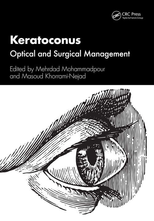 Book cover of Keratoconus: Optical and Surgical Management