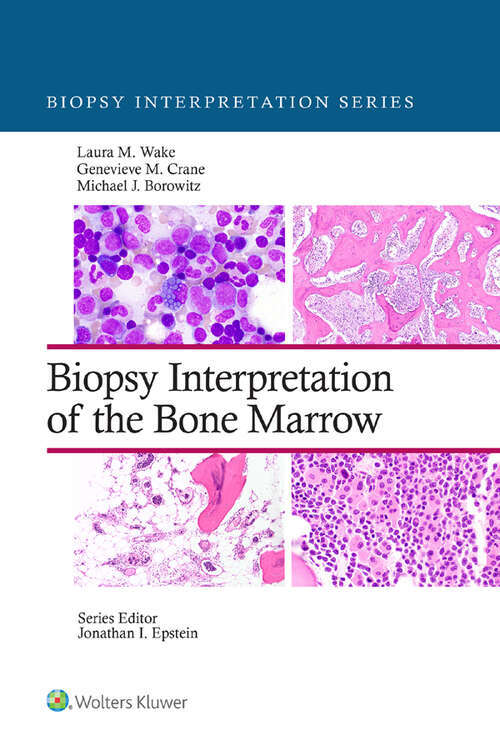 Book cover of Biopsy Interpretation of the Bone Marrow (Biopsy Interpretation Series)