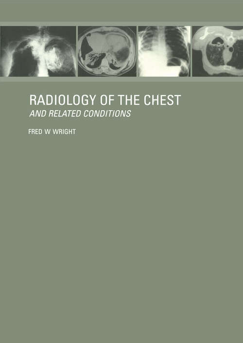 Book cover of Radiology of the Chest and Related Conditions