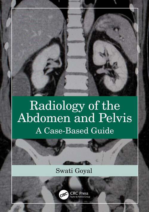 Book cover of Radiology of the Abdomen and Pelvis: A Case-Based Guide