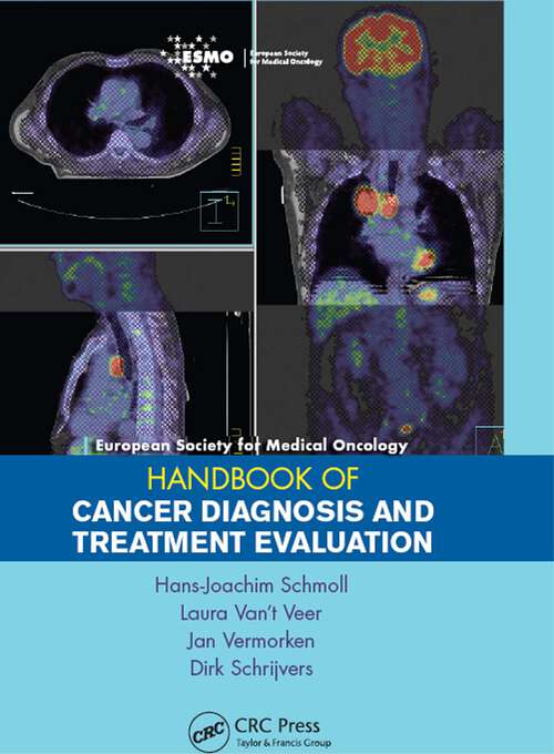 Book cover of ESMO Handbook of Cancer Diagnosis and Treatment Evaluation (European Society for Medical Oncology Handbooks)