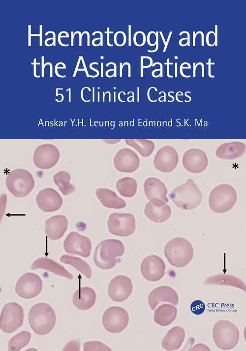 Book cover of Haematology and the Asian Patient: 51 Clinical Cases