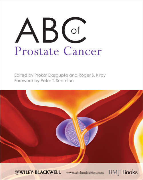 Book cover of ABC of Prostate Cancer