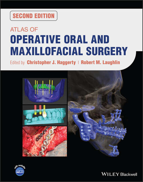 Book cover of Atlas of Operative Oral and Maxillofacial Surgery (2)
