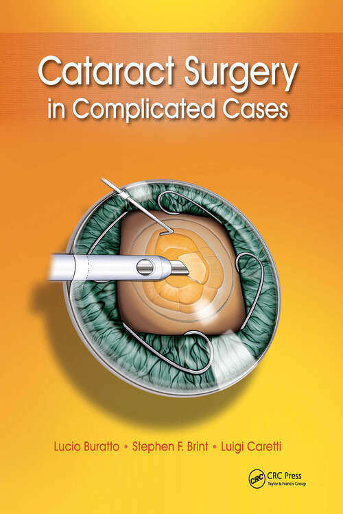 Book cover of Cataract Surgery in Complicated Cases