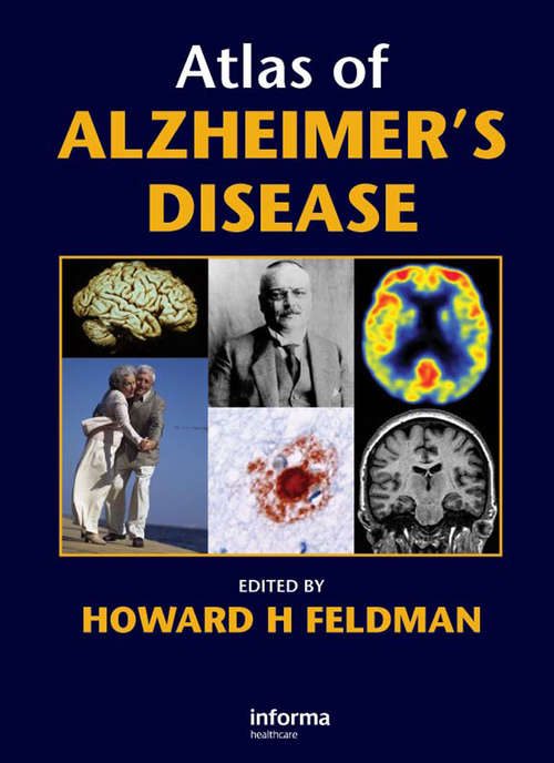 Book cover of Atlas of Alzheimer's Disease