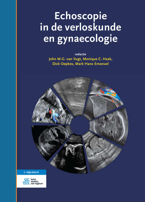 Book cover of Echoscopie in de verloskunde en gynaecologie