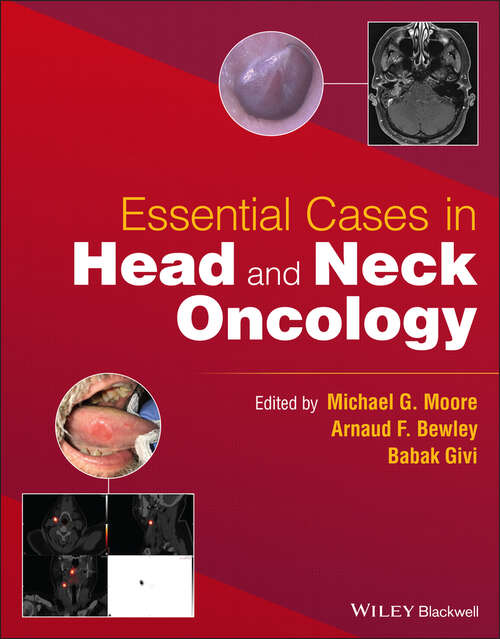Book cover of Essential Cases in Head and Neck Oncology