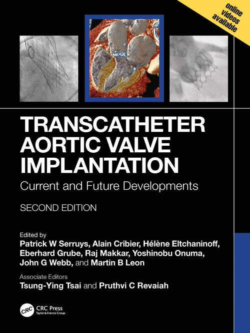 Book cover of Transcatheter Aortic Valve Implantation: Current and Future Developments