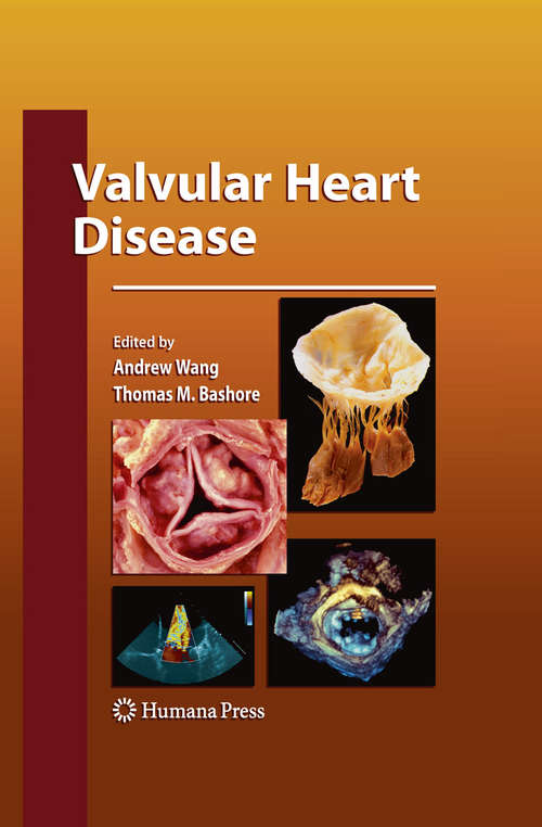 Book cover of Valvular Heart Disease