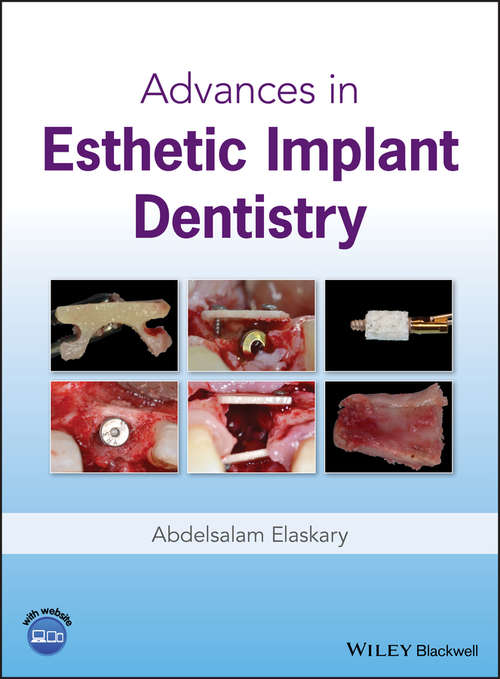 Book cover of Advances in Esthetic Implant Dentistry