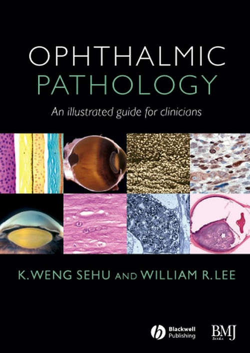 Book cover of Ophthalmic Pathology: An Illustrated Guide for Clinicians