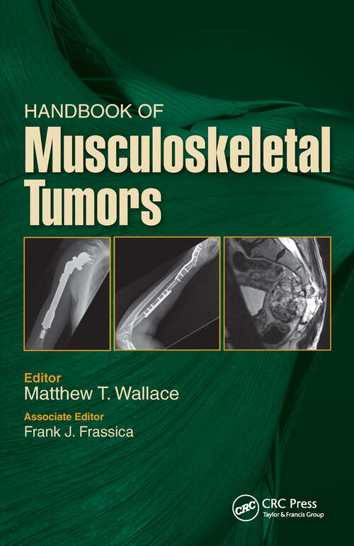 Book cover of Handbook of Musculoskeletal Tumors