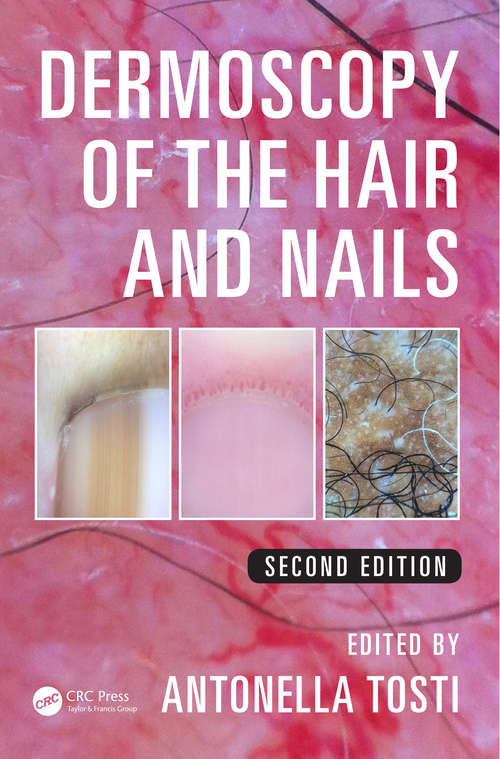 Book cover of Dermoscopy of the Hair and Nails