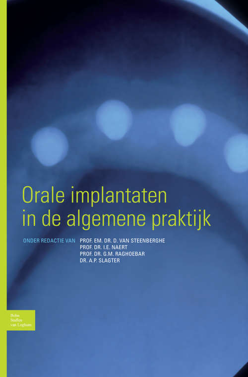 Book cover of Orale implantaten in de algemene praktijk