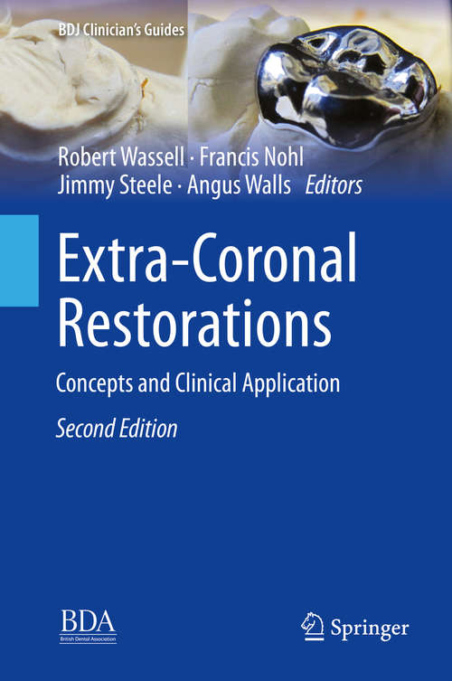 Book cover of Extra-Coronal Restorations: Concepts and Clinical Application (BDJ Clinician’s Guides)