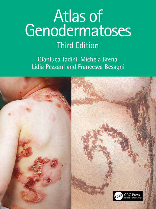 Book cover of Atlas of Genodermatoses (3)