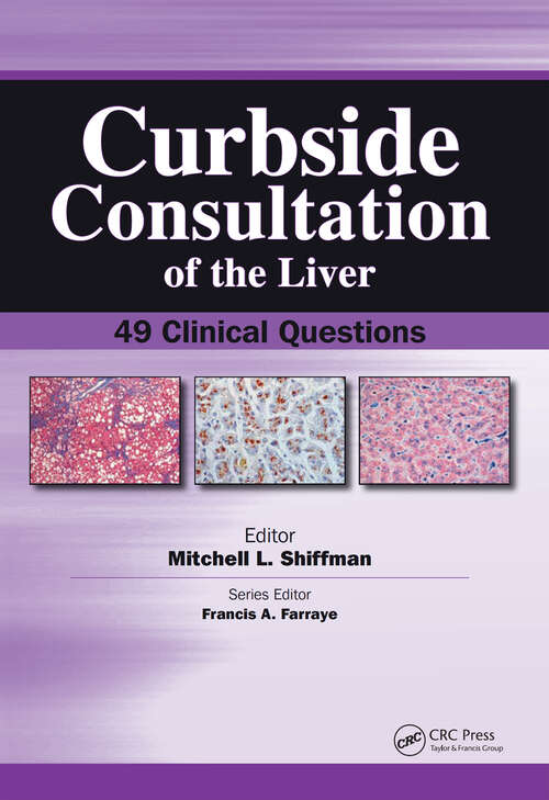 Book cover of Curbside Consultation of the Liver: 49 Clinical Questions (Curbside Consultation in Gastroenterology)