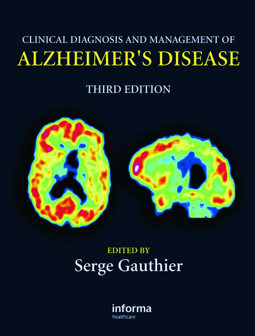 Book cover of Clinical Diagnosis and Management of Alzheimer's Disease