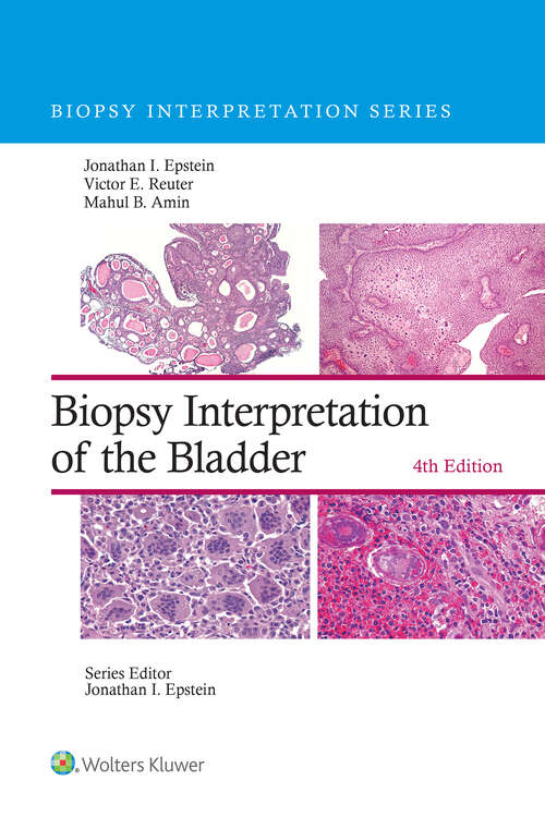Book cover of Biopsy Interpretation of the Bladder (Biopsy Interpretation Series)