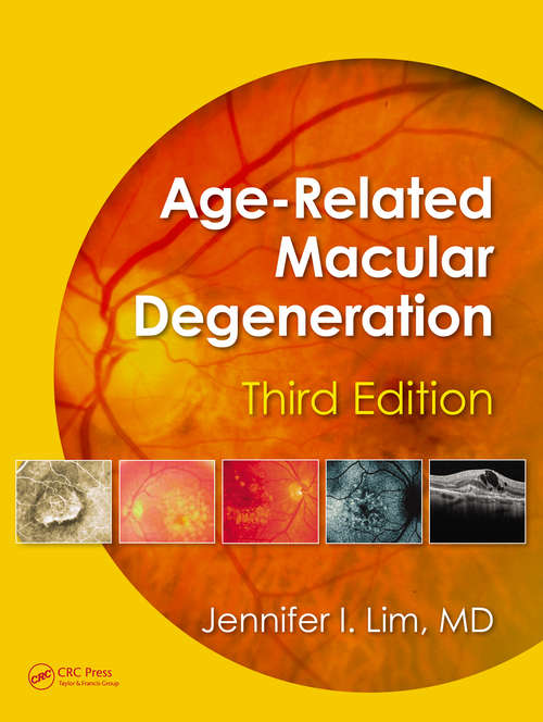 Book cover of Age-Related Macular Degeneration