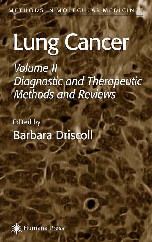Book cover of Lung Cancer, Volume 2: Diagnostic and Therapeutic Methods and Reviews