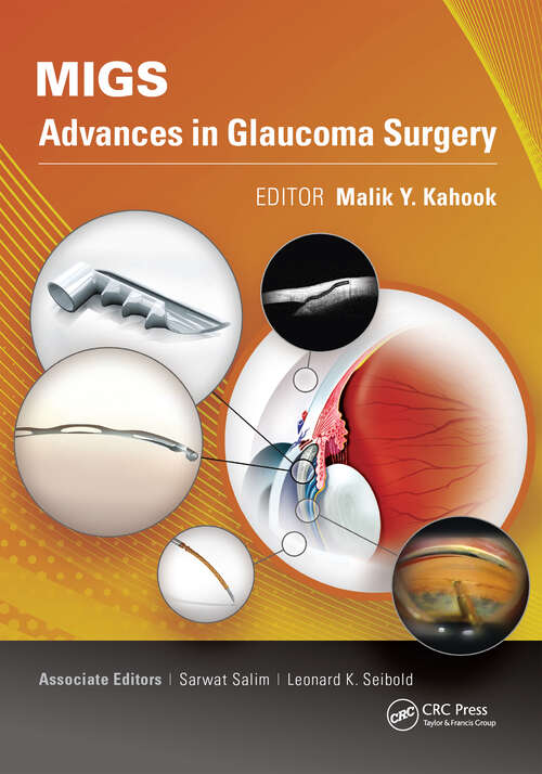 Book cover of MIGS: Advances in Glaucoma Surgery