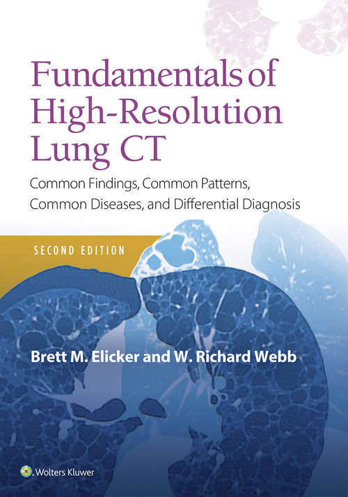 Book cover of Fundamentals of High-Resolution Lung CT: Common Findings, Common Patterns, Common Diseases and Differential Diagnosis (3)