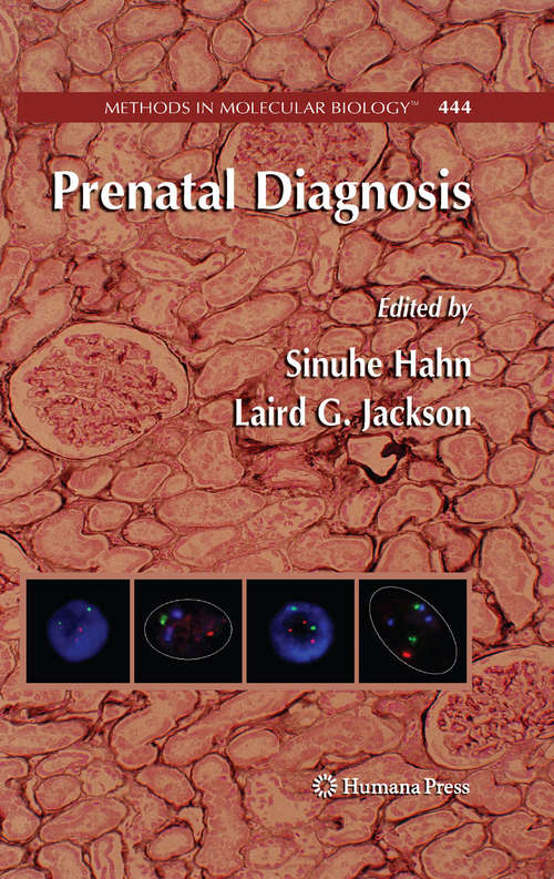 Book cover of Prenatal Diagnosis