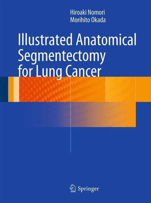 Book cover of Illustrated Anatomical Segmentectomy for Lung Cancer