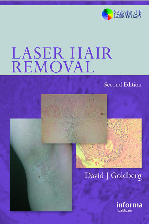 Book cover of Laser Hair Removal (Series in Cosmetic and Laser Therapy)