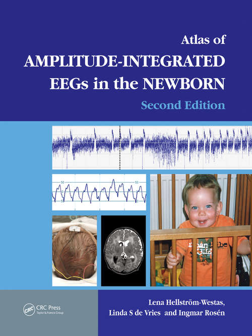 Book cover of An Atlas of Amplitude-Integrated EEGs in the Newborn (2)